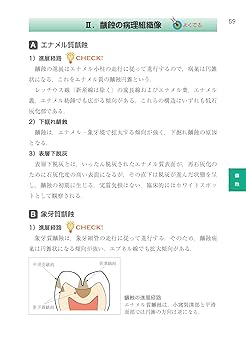 病理学・口腔病理学 (歯科国試パーフェクトマスター) | 槻木